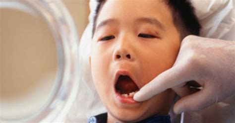 verzekering dekt tandarts zelden helemaal gezond adnl