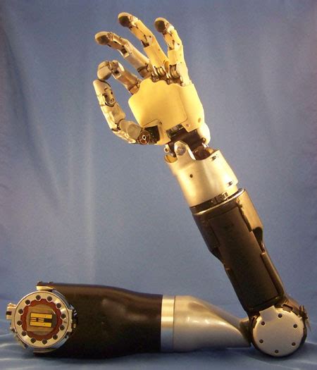 blessed prosthetic limbs