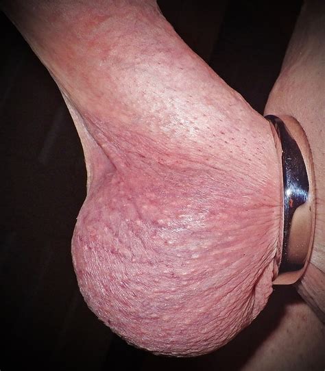 a very tight cock ring on my cock and balls 1 pics