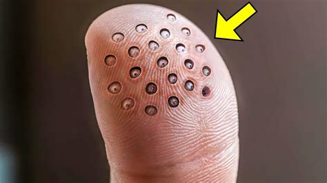 man  weird  spots  finger   doctors    call