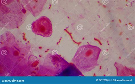 Bacteria Cell Gram Neagative Bacilli With Capsule Pathogen Sample