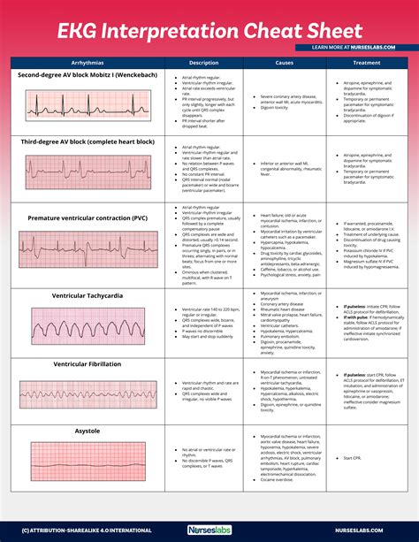 Ekg Interpretation Cheat Sheet And Heart Arrhythmias Guide
