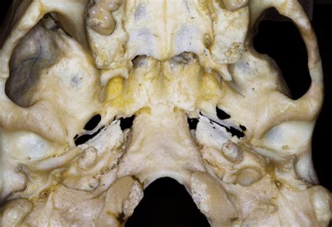 Inferior View Of The Central Portion Of A Bony Skull Neuroanatomy