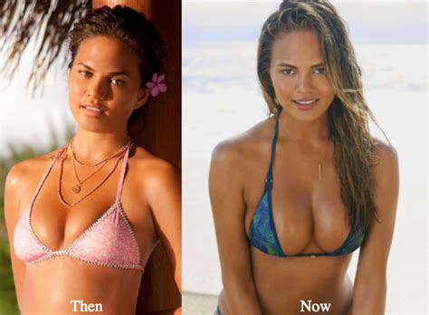 before and after pics of breast augmentation hot nude