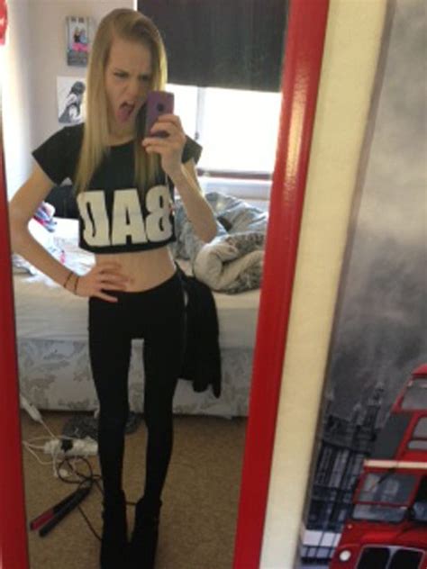 Thinspiration Selfies Almost Killed Me Anorexia