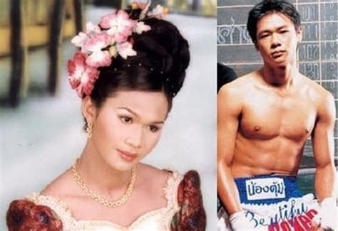 Viral Photos Women Who Were Men Cosmetic Surgery 24