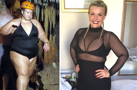 Morbidly Obese Woman Loses 10st Naturally This Is How