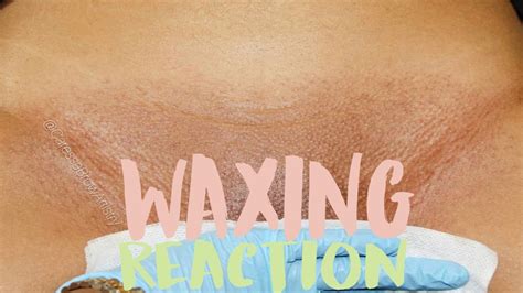 The Brazilian Wax A History And How To