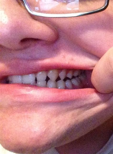 teeth  unusually sharp rmildlyinteresting