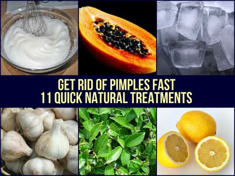 natural ways   rid  pimples fast