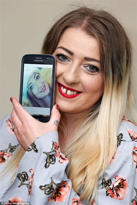 woman 29 reveals how she developed rotting teeth after getting contraceptive coil daily mail