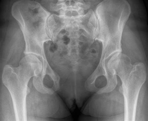 x ray of the inside of a pussy bobs and vagene