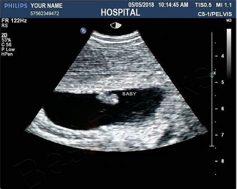 Пин на доске fake ultrasound