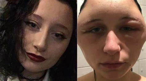 beware  hair dye  girl claims   died   health news medibulletin