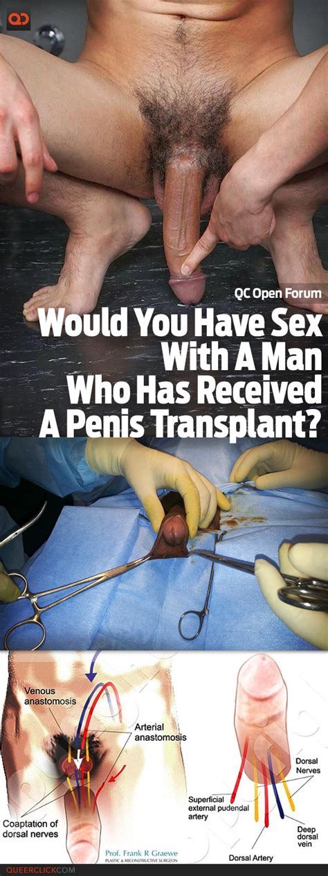 organ sex transplant hot porno