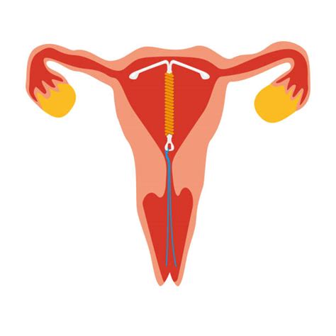 iud doctor illustrations royalty free vector graphics and clip art istock