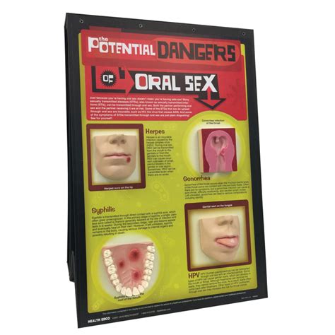 the potential dangers of oral sex 3 d display health edco