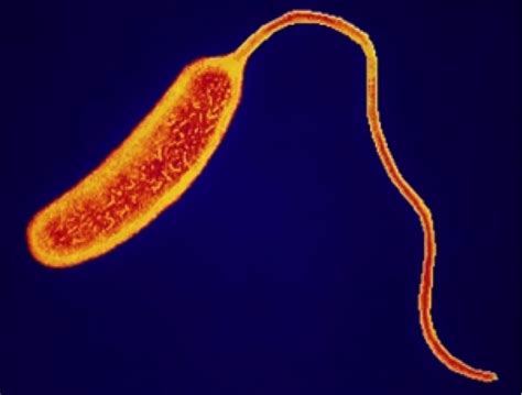 cholera  deadly disease