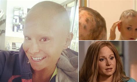 being bald in hollywood model and actress struck by alopecia reveals she is enjoying career
