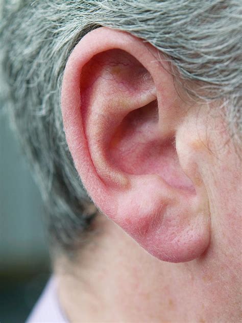 Man S Ear Photograph By Gustoimages Science Photo Library Fine Art
