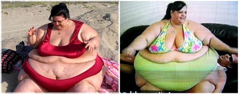 Obese Woman Drops 110kg After Breaking Up With Feeder