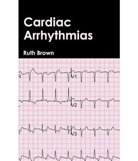cardiac arrhythmias buy cardiac arrhythmias    price