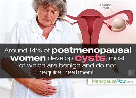 Are Ovarian Cysts Common In Postmenopause