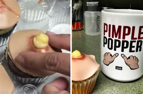 A Baker Invented Pimple Cupcakes That Pop When You Squeeze Em