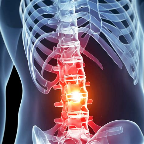 spinal cord injury cureisin