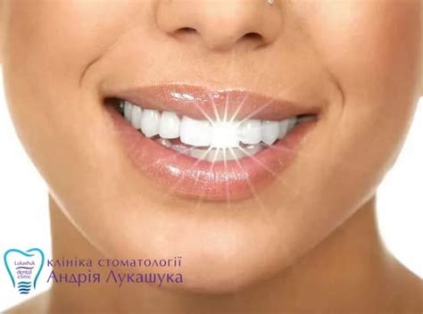 Белоснежная улыбка и здоровые зубы не одно и тоже Клиника Лукашука