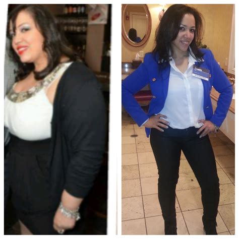 Heavy Girl To Healthy Girl A Journey With Gastric Bypass