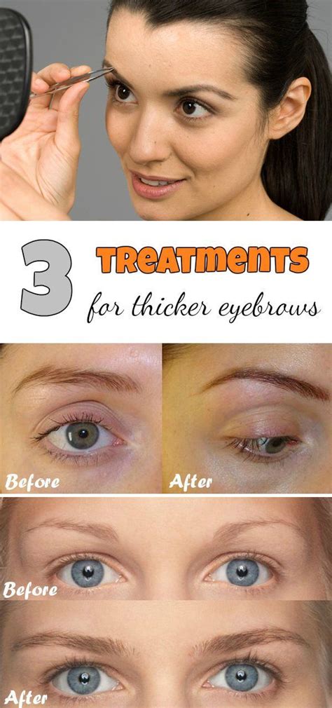 3 Treatments For Thicker Eyebrows Thick Eyebrows Beauty Hacks