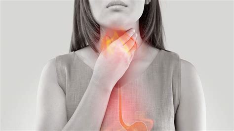 surprising facts  heartburn  gerd