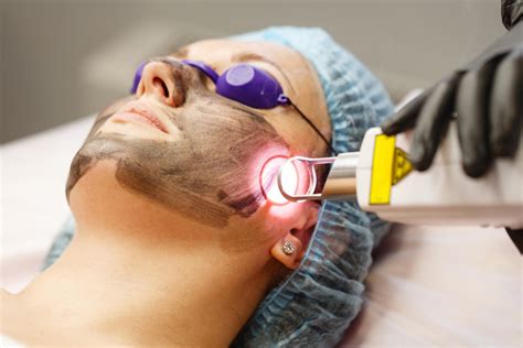 laser    la pelle tipi risultati precauzioni
