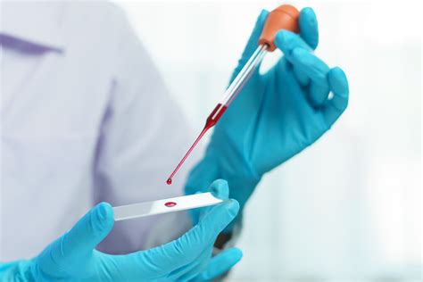 complete blood count test    significance  importance