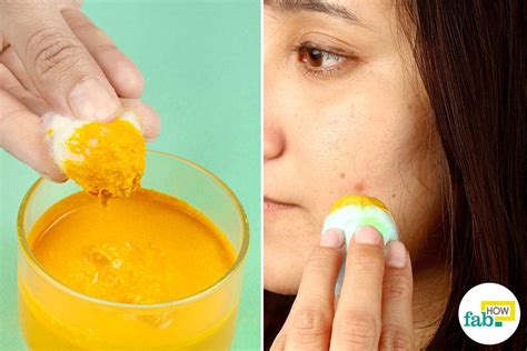 how to get rid of dark spots on face with just 1 ingredient