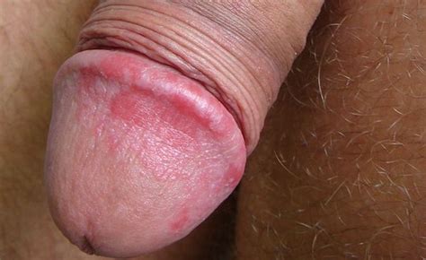 male penis problems full real porn