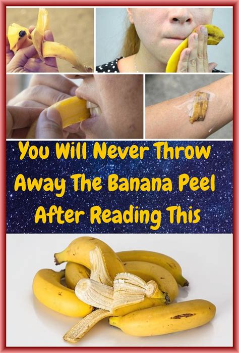 Banana Peel Remedies – You Will Never Throw The Banana Peel After