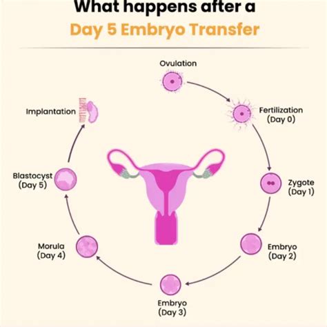day  day   embryo transfer nua fertility