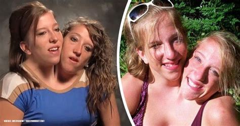 worldwide famous conjoined twins opened up about their