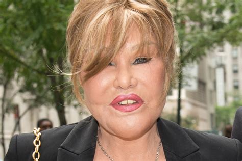 Catwoman Jocelyn Wildenstein Claims She S Never Had