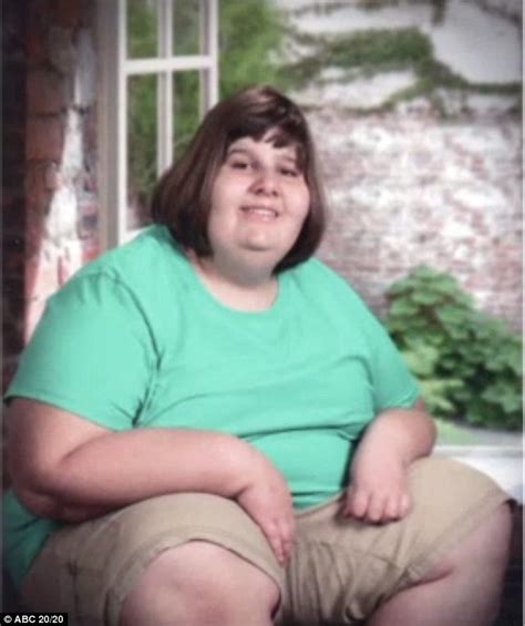 Prader Willi Syndrome Left 14 Year Old Hannah Unable To Stop Eating