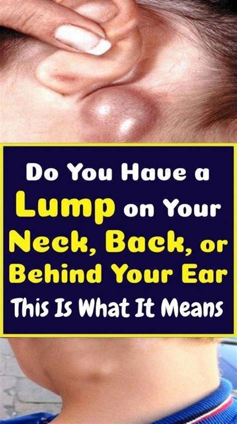 youve  lump   neck     ear     means