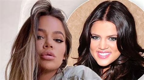 Khloe Kardashian S Plastic Surgery Journey In Full After She Confirmed