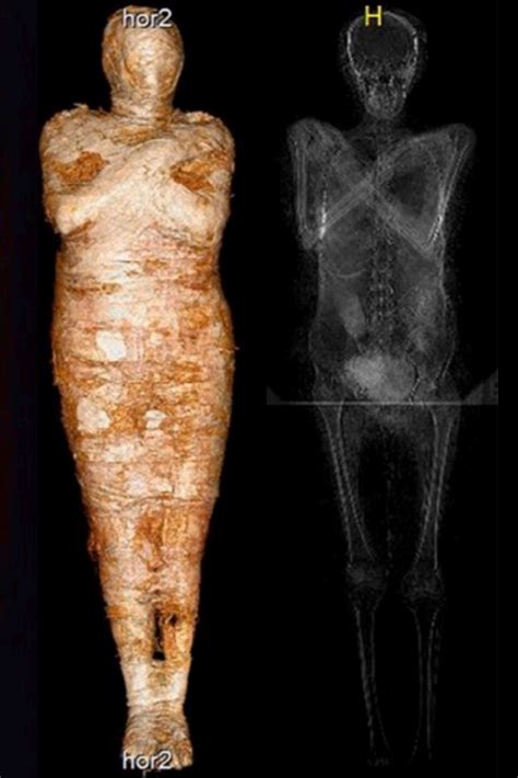 Ancient People In Ancient Times Inca X Ray Images Egyptian Mummies