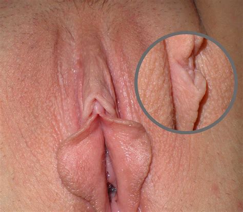 clitoris penis tubezzz porn photos