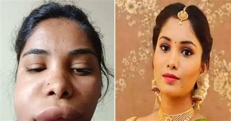 South Actress Swathi Sathish Looks Unrecognisable After Root Canal