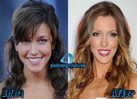 katie cassidy plastic surgery before and after