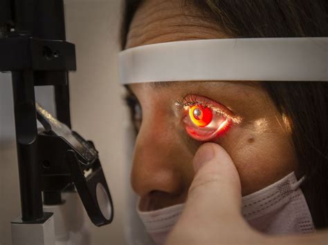 optician warns  costume contact lens dangers toronto sun