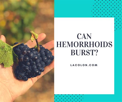burst hemorrhoid symptoms